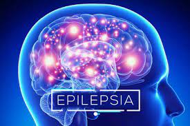 epilepsia criptogenica